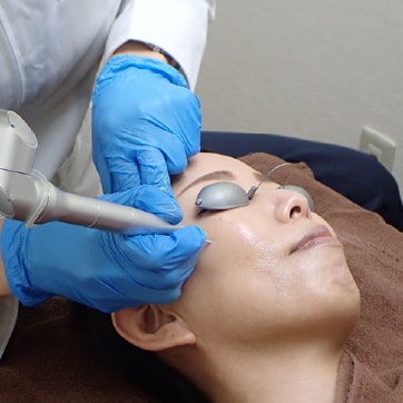 炭酸ガス(CO2)レーザー